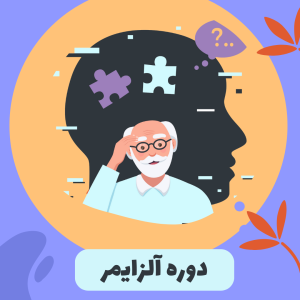 آلزایمر